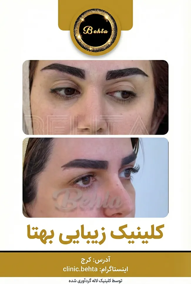 کلینیک زیبایی بهتا