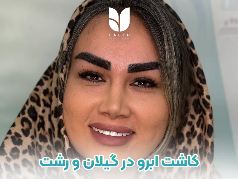 کاشت ابرو در گیلان