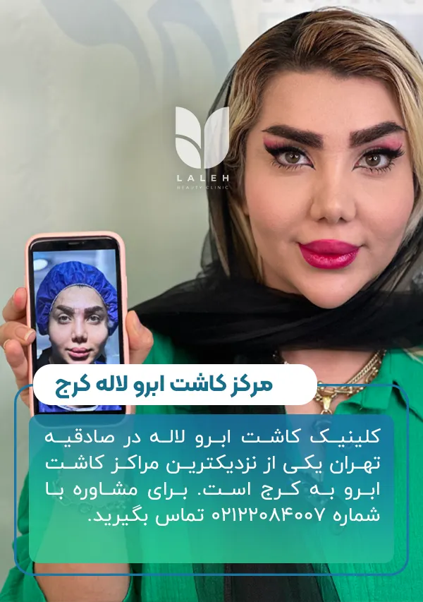 معرفی کلینیک کاشت ابرو لاله