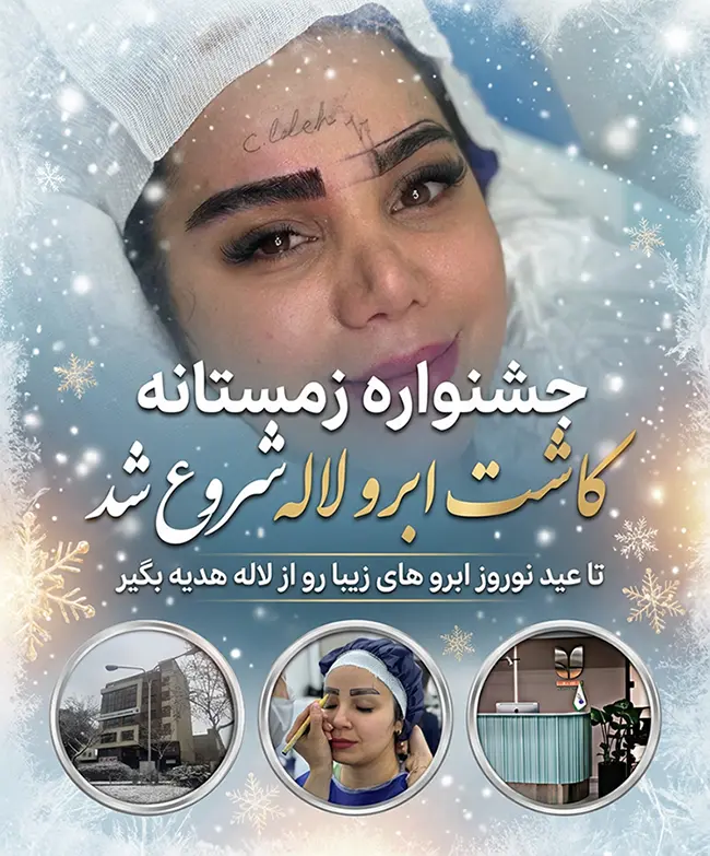 جشنواره کاشت ابرو لاله