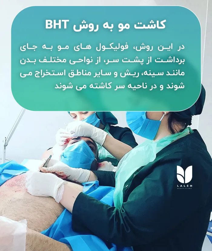 کاشت مو به روش BHT در کلینیک لاله