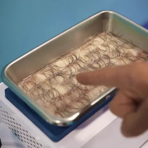 برداشت مو از بانک مو بدن