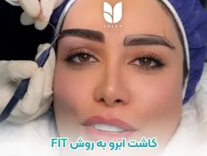 کاشت ابرو به روش FIT