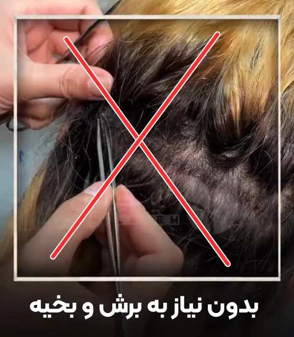 کاشت ابرو بدون بخیه