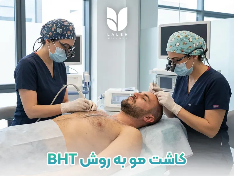 کاشت مو به روش BHT