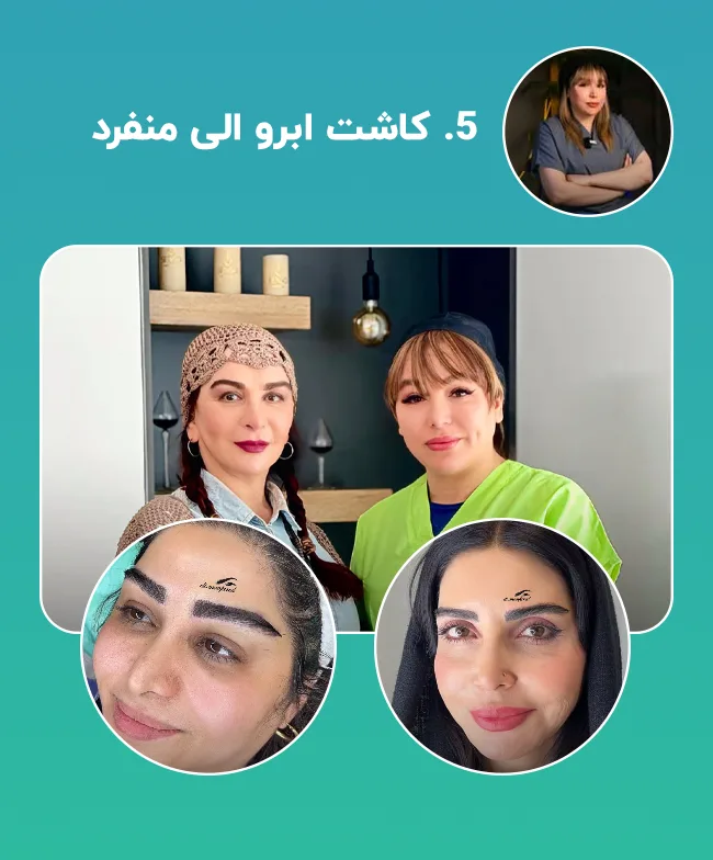 کاشت ابرو الی منفرد شیراز