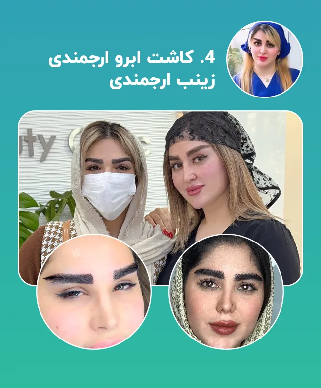 کاشت ابرو زینب ارجمندی شیراز