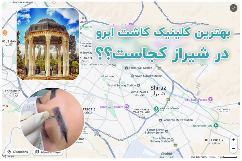 کاشت ابرو در شیراز