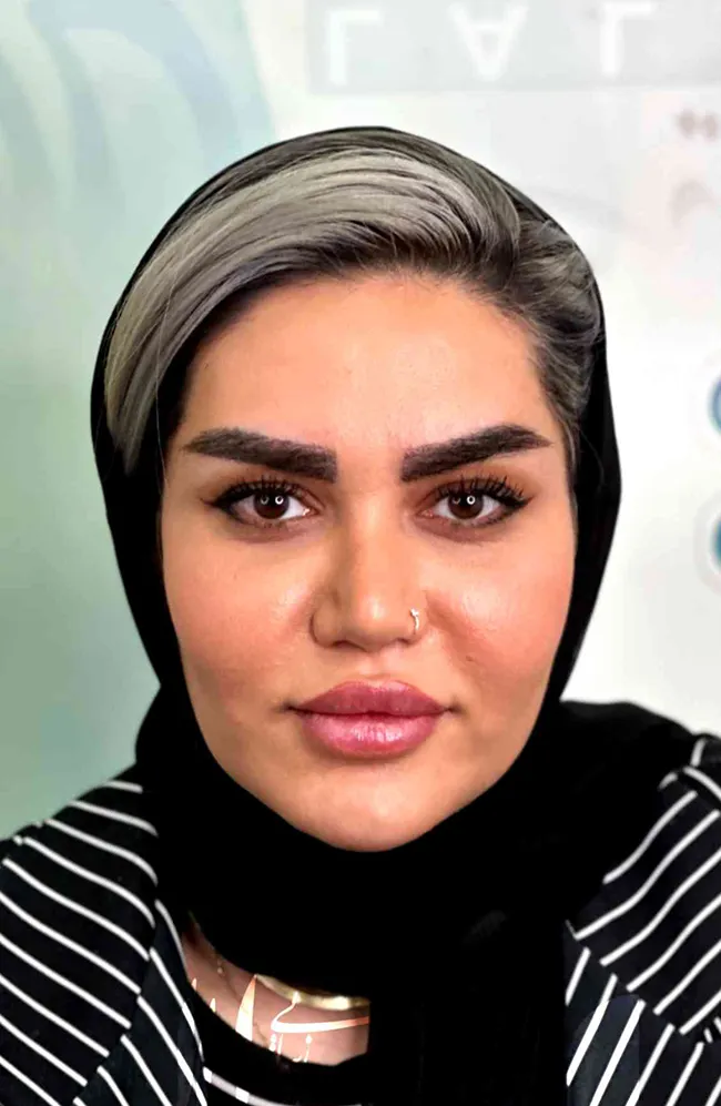 کاشت ابرو لاله