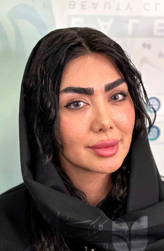 کاشت ابرو لاله