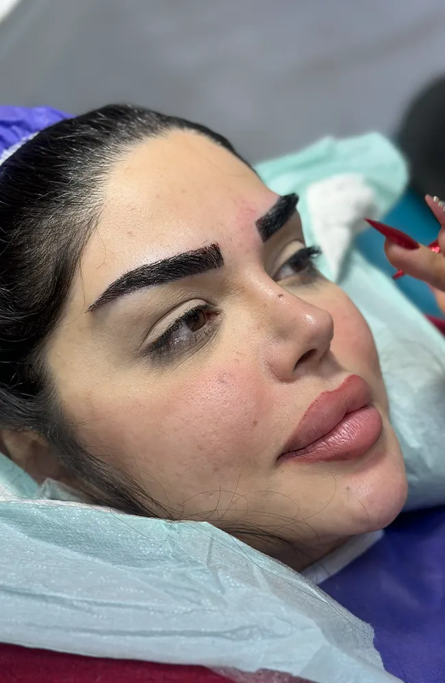 کاشت ابرو لاله