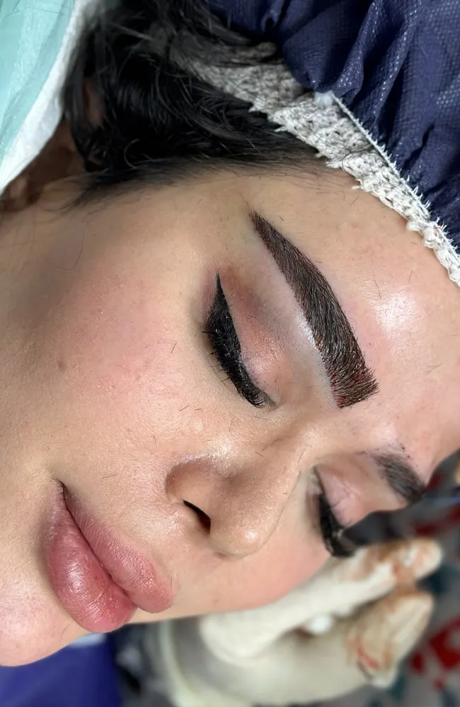 کاشت ابرو لاله