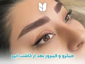 میکروبلیدینگ و فیبروز بعد از کاشت ابرو