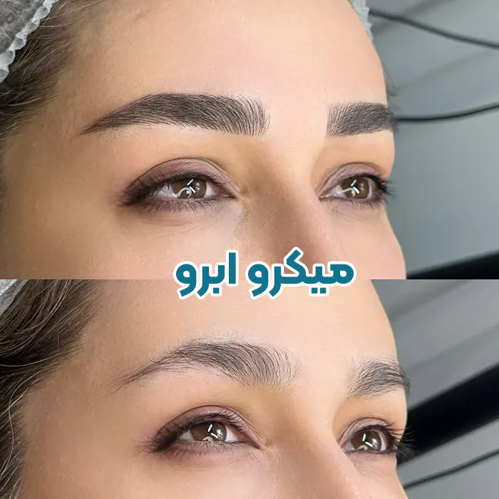 میکرو ابرو
