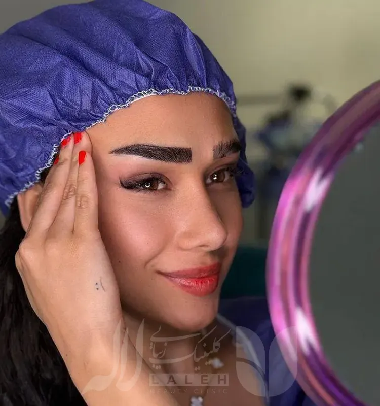 کاشت ابرو