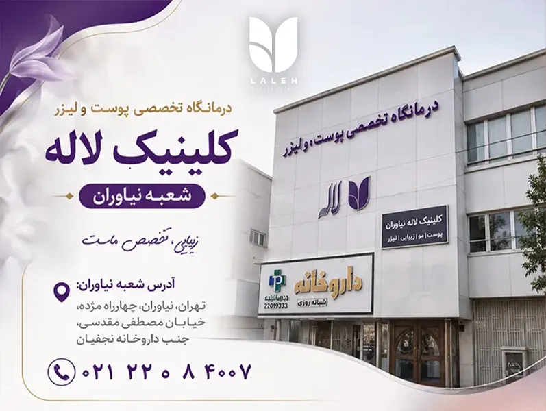 کاشت ابرو لاله نیاوران