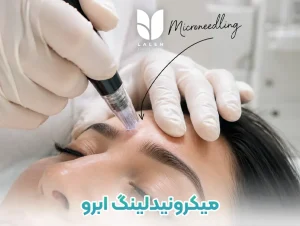 میکرونیدلینگ ابرو برای تقویت ابرو