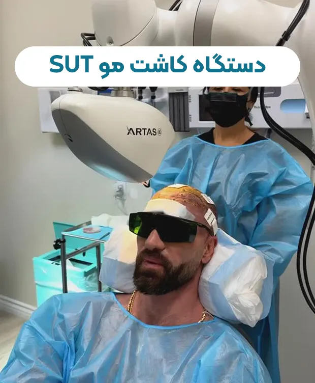 کاشت مو به روش SUT