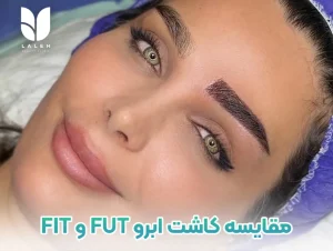مقایسه کاشت ابرو FIT و FUT