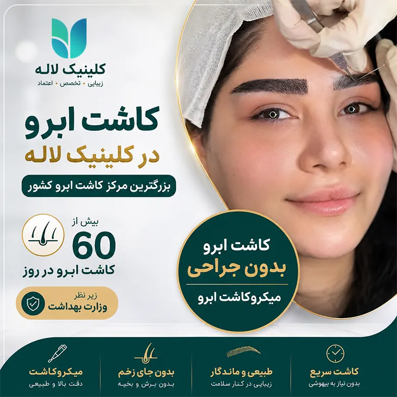 کاشت ابرو لاله