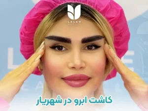 کاشت ابرو در شهریار