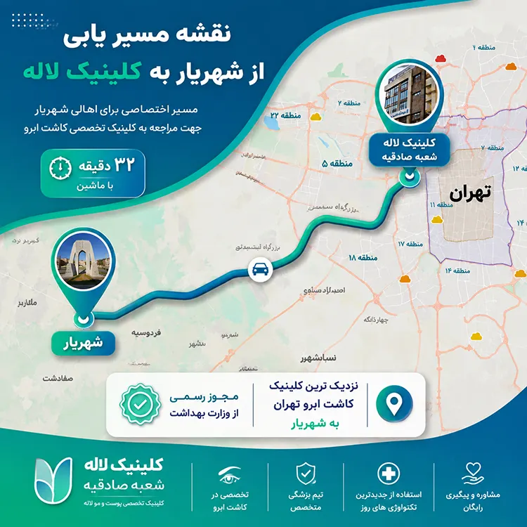 کاشت ابرو در شهریار