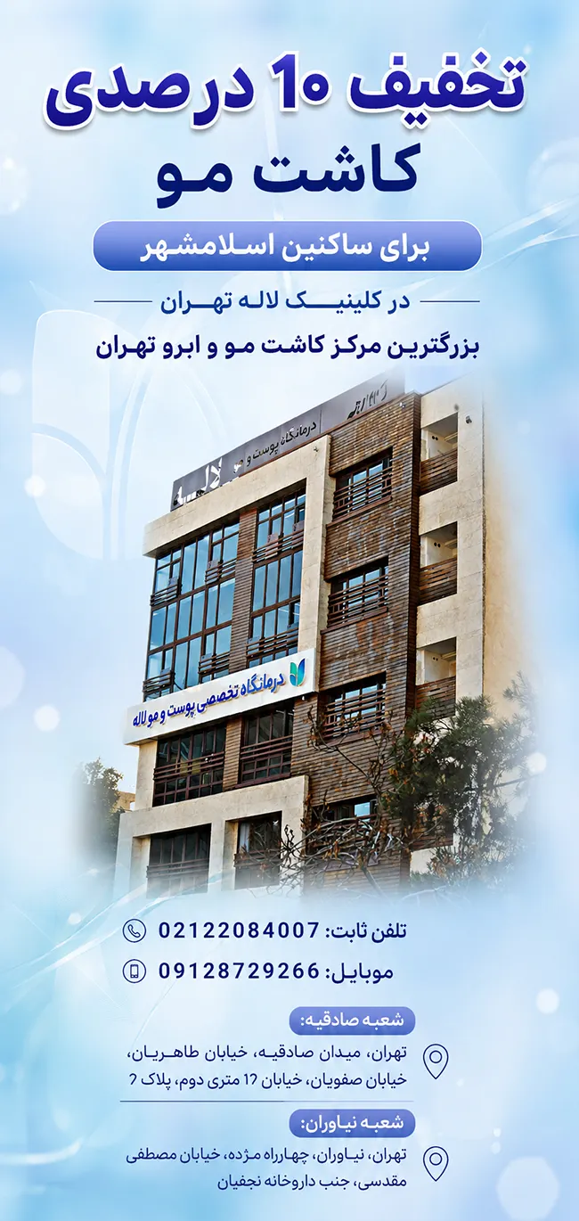 کاشت مو برای ساکنین اسلامشهر