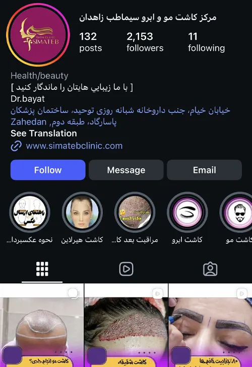 مرکز کاشت مو و ابرو سیماطب زاهدان