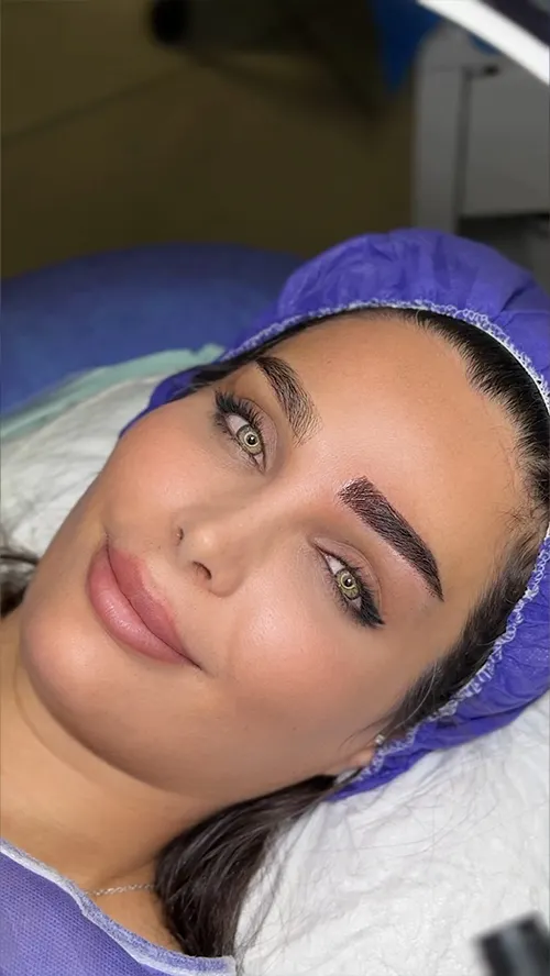 میکروکاشت ابرو در لاله
