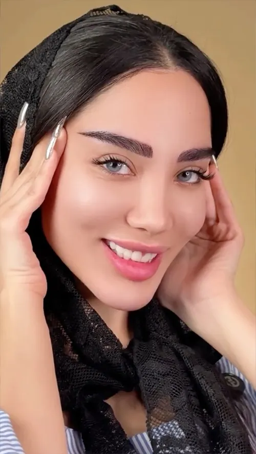 کاشت وی ای پی ابرو 