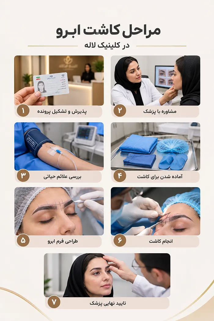 مراحل کاشت ابرو در کلینیک لاله