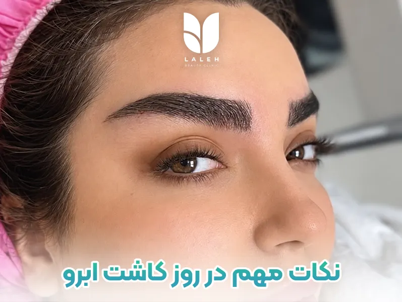 نکات مهم در روز کاشت ابرو